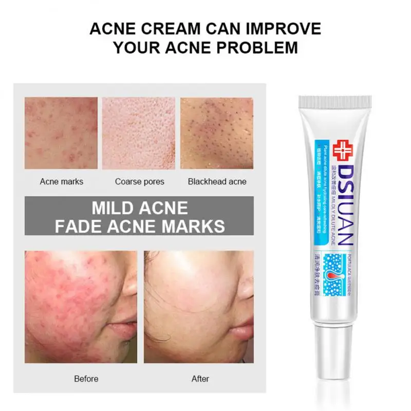 

Bai Zhen Tang Skin Research Skin Care Whitening Cream Moisturizing Shrink Pore Cream Freckle Cream Acne Cream Face Care
