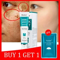 effective whitening freckles face cream fade melasma dark spots pigment corrector moisturizing brightening facial skin care 20g
