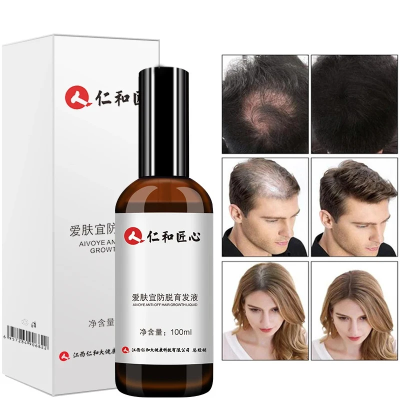 100ml Shouwu Hair Growth Essence Anti-Alopecia Hair Salon Essence Oil Repair Hairline and Scalp Care Essence with Ginger
