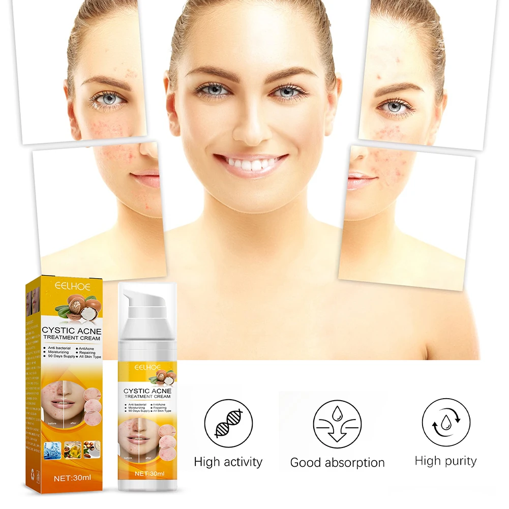 

Крем для удаления акне, 30 мл