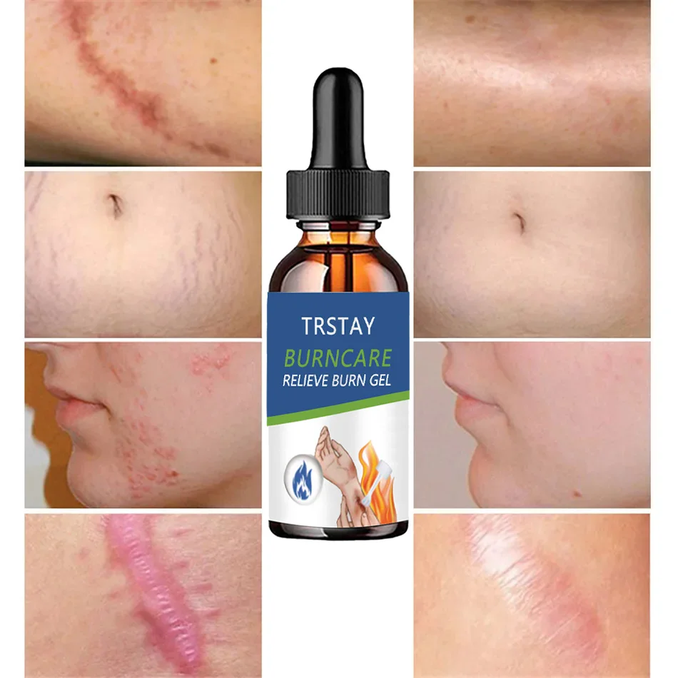 Снимает ожоги гель от красноты лица