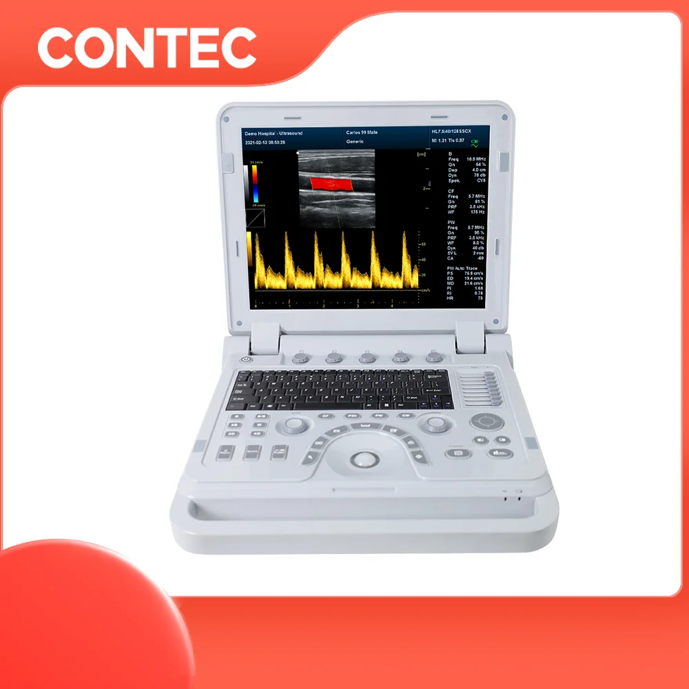 CONTEC 1700A профессиональная сонография эхокардиография сосудистый ультразвук