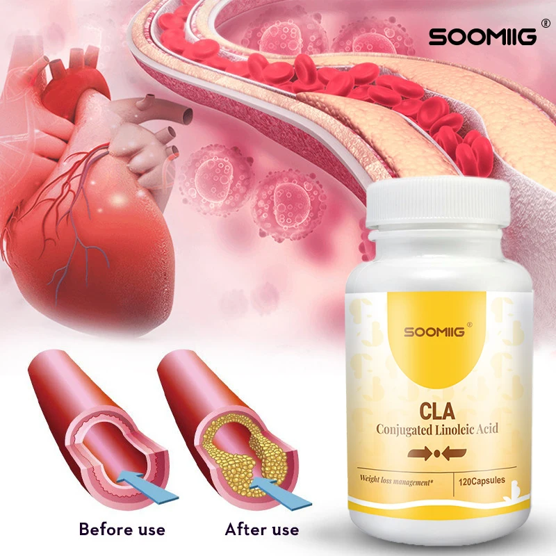 

Soomiig CLA Supplement -Supports Weight Loss & Fat Burning, Heart & Digestive Health, Balances Blood Sugar Levels,boost Energy