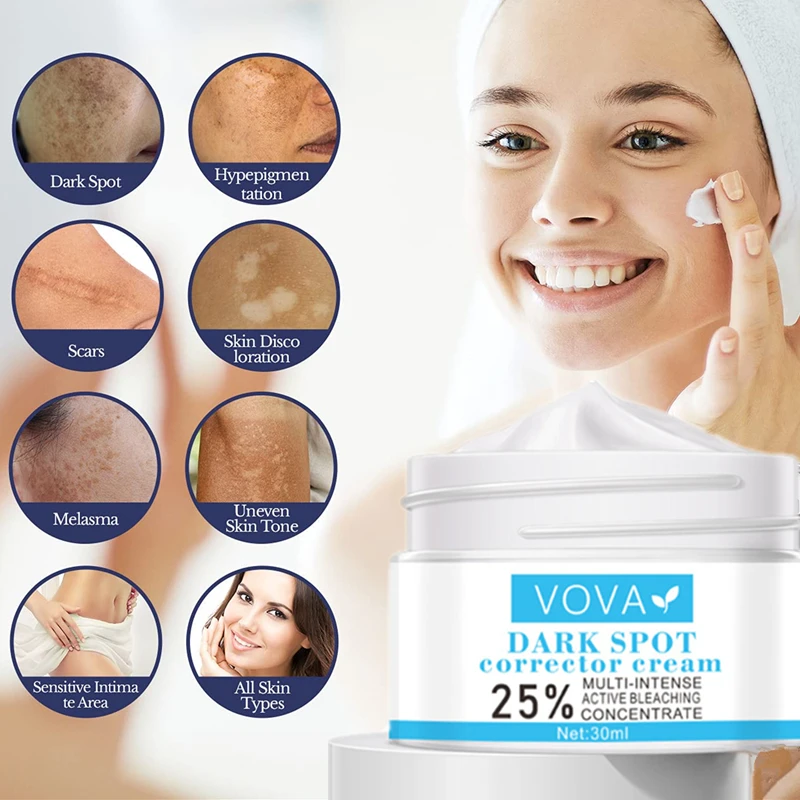 

5 second Instant Freckle Cream Remove Dark Spots Witening Cream Fade Acne Scars Melanin Pigmentation Melasma Anti-Aging Skin