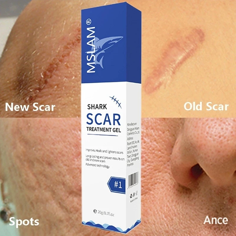 

Крем для удаления шрамов, средство для лечения растяжек, крем для хирургического восстановления шрамов, сглаживание и отбеливание кожи