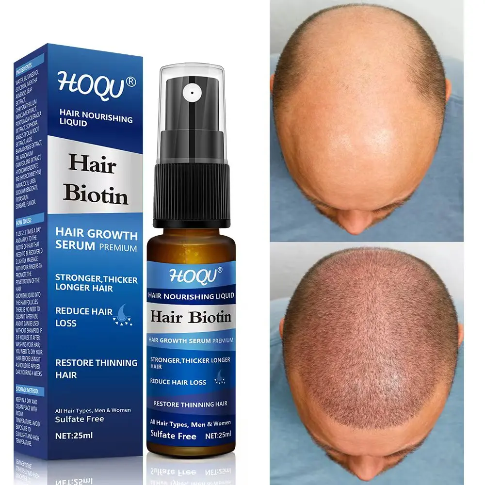 

Hair Growth Product Essential Oil Natural Anti Hair Loss Biotin Fast Grow Prevent Baldness Treatment Liquid For Men Women