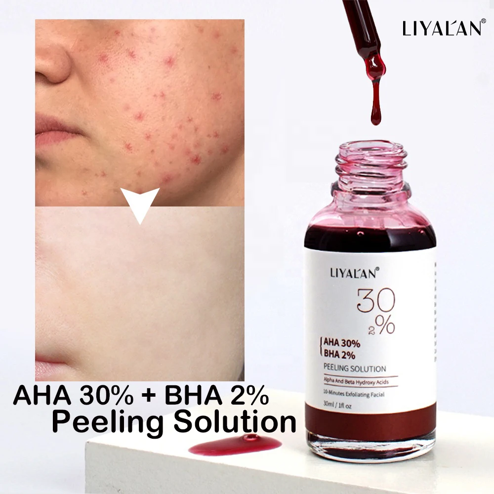 

AHA 30% BHA 2% Peeling Solution Face Serum Remove Acne Repair Scar Fade Fine Lines Exfoliating Shrink Pores Skin Care Face Serum