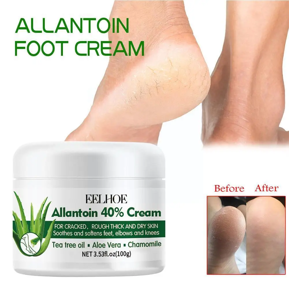 

Urea 40% Foot Cream Anti-Drying Crack Foot Cream Heel Repair Skin Feet Remove Hand Care Cream Dead Smooth Moisturizing Crac W2W1