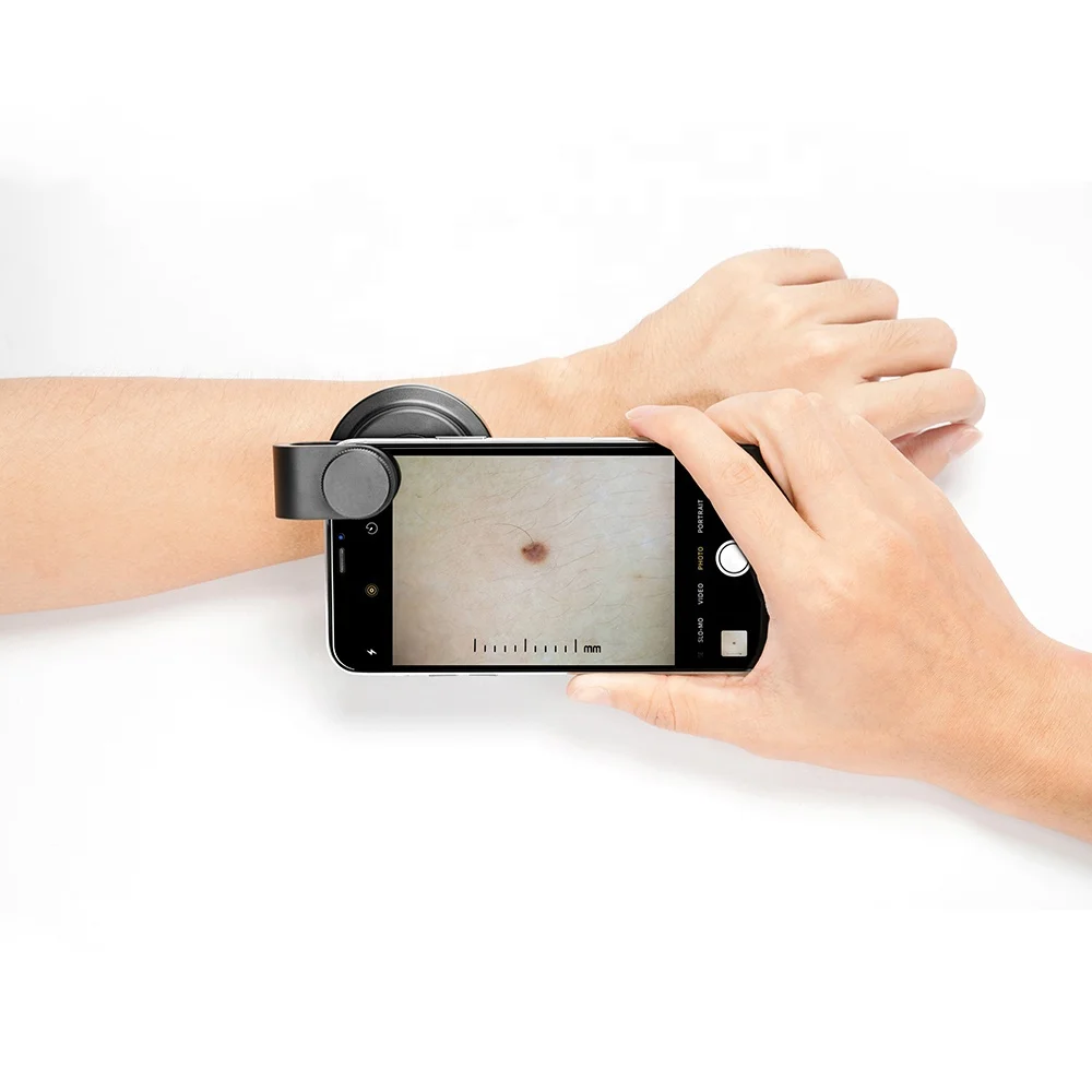 IBOOLO DE-400 Портативный USB перезаряжаемый медицинский дермоскопический дерматоскоп