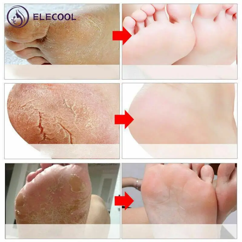 

Volcanic Mud Anti-Aging Moisturizing Foot Mask Socks Nicotinamide Whitening Smoothing Foot Spa Mask Skin Care 1Pairs