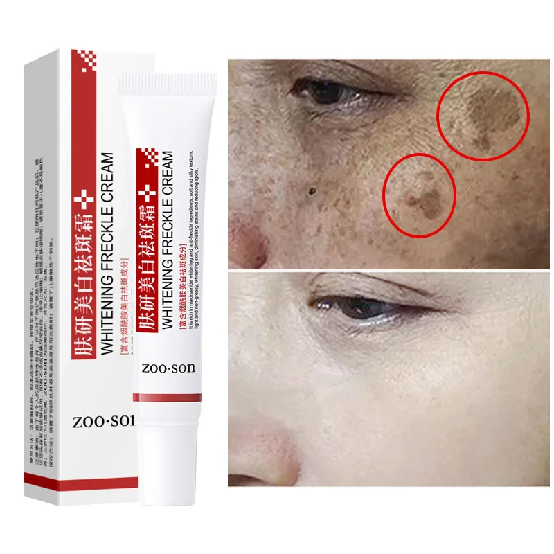 

Facial Quickly Remove Dark Spots Cream Eliminate Spots Melasma Whiten Fade Melanin Brighten and Even Skin Tone Moisturizing 20g