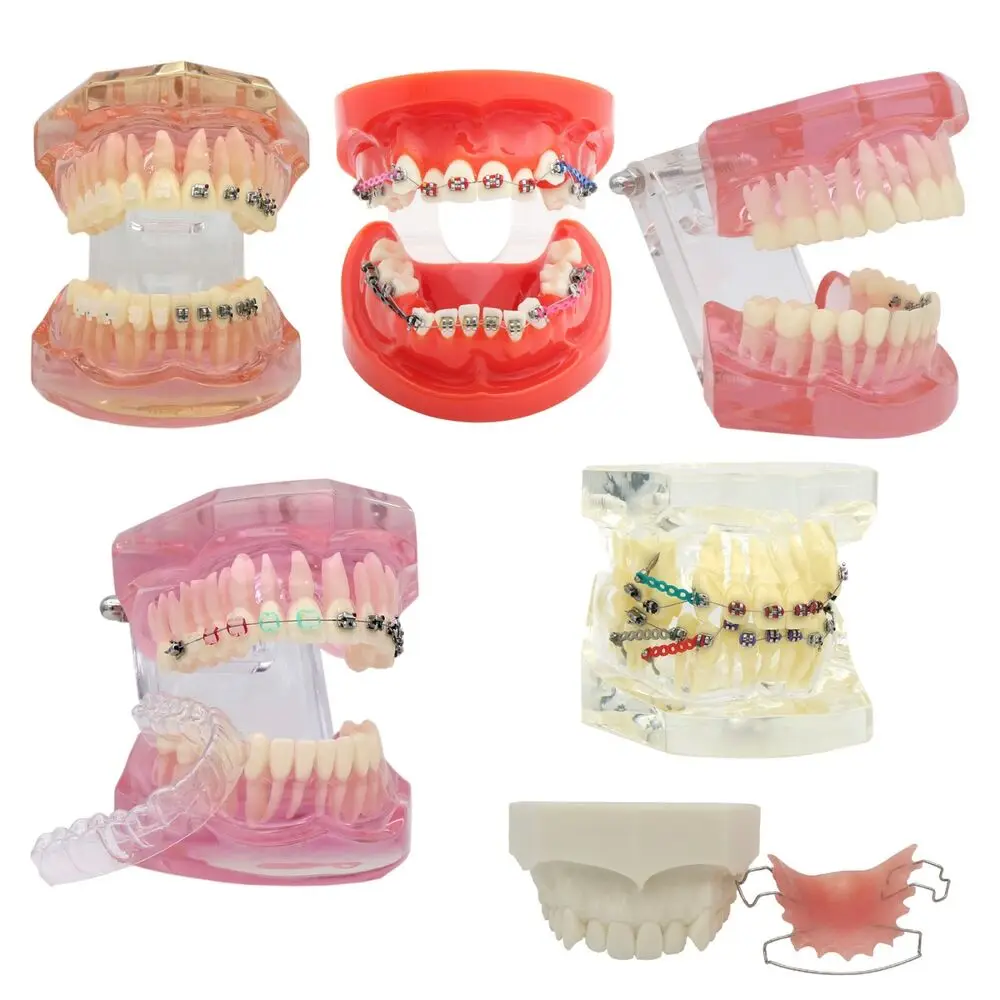 Dental Orthodontic Metal/Ceramic/Invisible Brackets Lingual Brace Teeth Model