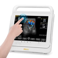ultrasound excellent image scanner pt50a hospital clinic ultrasound scanner digital portable ultrasound scan