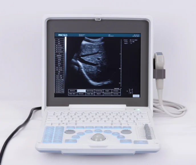 

Hot Selling Excellent Image Technology Ultrasound Device 12 Inch Digital Ultrasonic System
