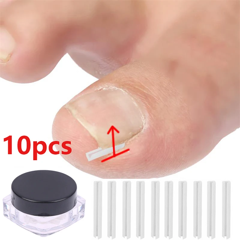 

10pcs Ingrown Toenail Correction Tool Ingrown Toe Nail Treatment Elastic Patch Sticker Straightening Clip Brace Pedicure Tool
