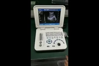 wholesale factory direct sales fashionable pregnancy ultrasound scanner