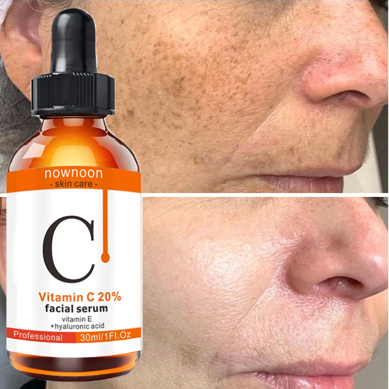 Vitamin C Antioxidant Whitening Serum Remove Melanin Moisturizer Brighten Improve Skin Dullness Smooth Face Beauty Care Products