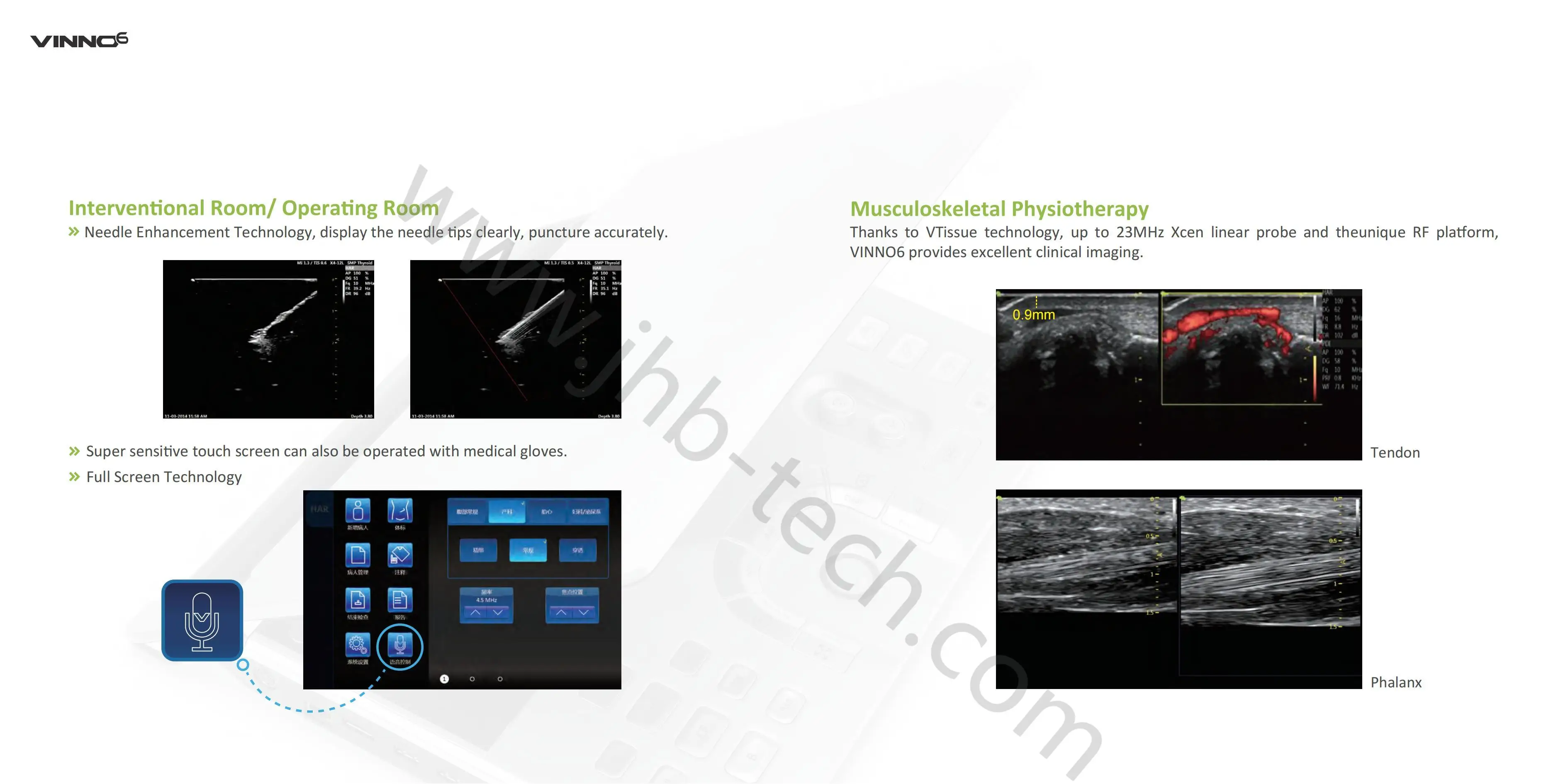 Медицинские ультразвуковые инструменты VINNO 6 портативный цветной допплер 4D