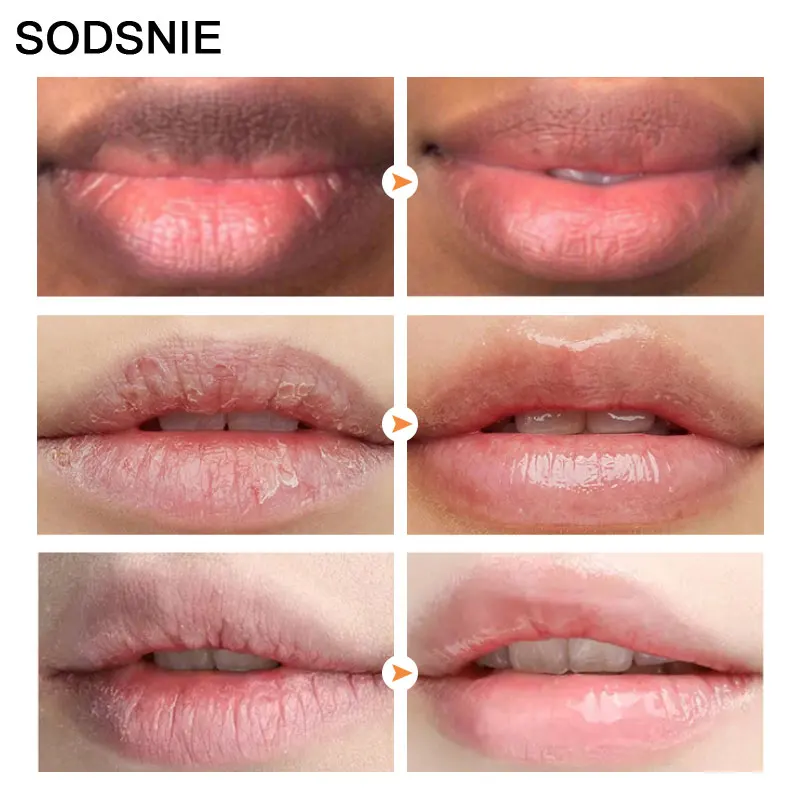 Маска для губ с пузырьками натуральная пена улучшение темных увлажнение