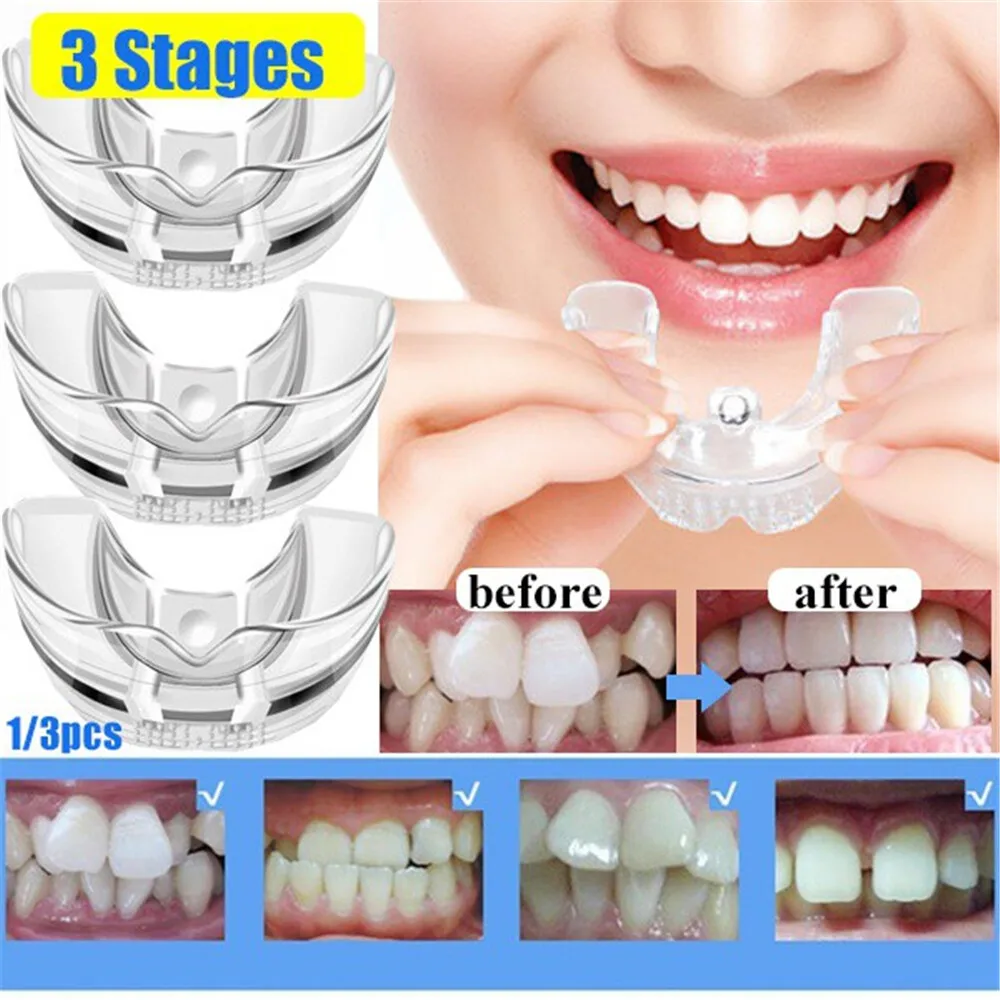 

3 Pieces/set Invisible Braces Teeth Orthodontic Aligner Straightener Transparent Braces Tooth Guard Anti-Wear Teeth with Box