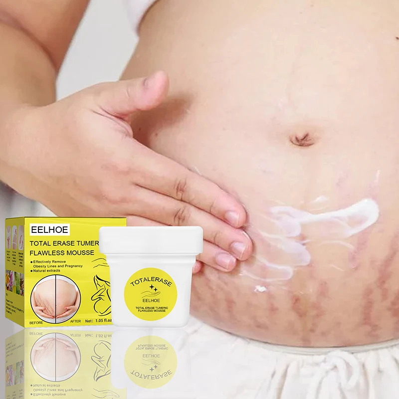 

30 г крем для удаления рубцов после беременности, угрей, растяжек для беременных, восстанавливающий кожу, антивозрастной крем для восстановл...