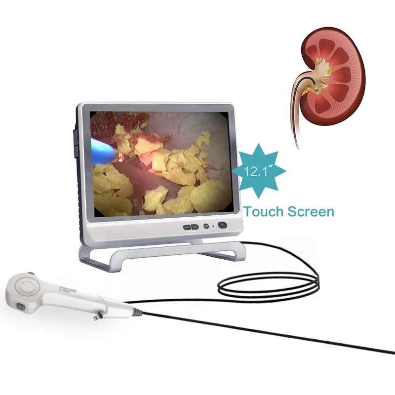 

7.5fr 9.5fr Flexible Disposable Ureteroscope Single Use Urology Endoscope Digital Video Uretero-Renoscope 2.5mm 2.8mm