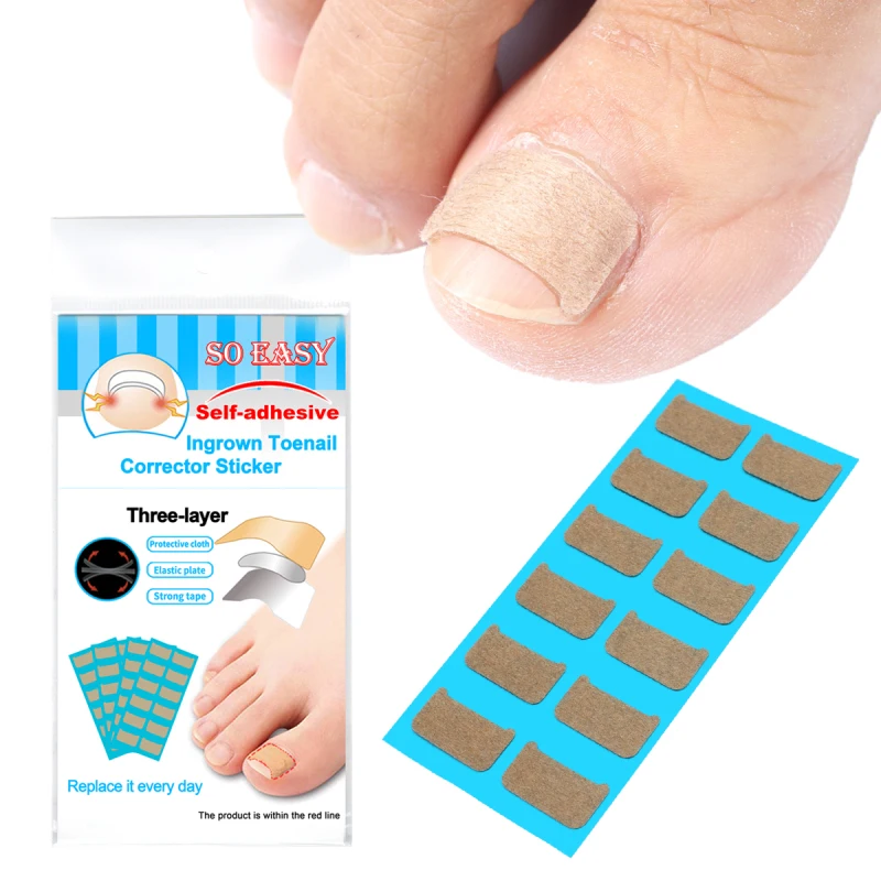 

Nail Ingrown Sticker Double-sided Glue Ingrown Nail Corrector Tool Paronychia Recover Corrector Pedicure Tools