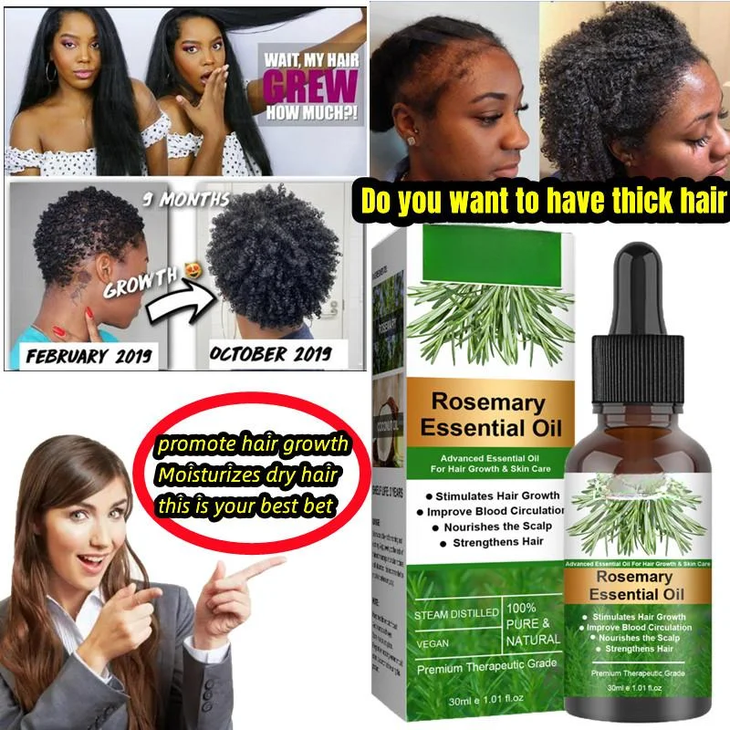 

Rosemary Hair Care Essential Oil Alopecia Treatment Anti Hairs Loss Growth shampoo Regrow Hairline Back Fix Bald Spots Thinning