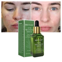 for breylee face care nose blackhead remover serum face black peeling mask shrink pores essence oil control face sheet skin care