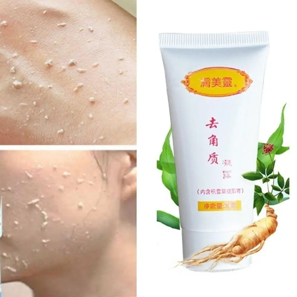 

30g Centella asiatica Exfoliating Gel Deep Moisturizing Oil Control Shrink Pores Brightening Skin Whitening Firming Care