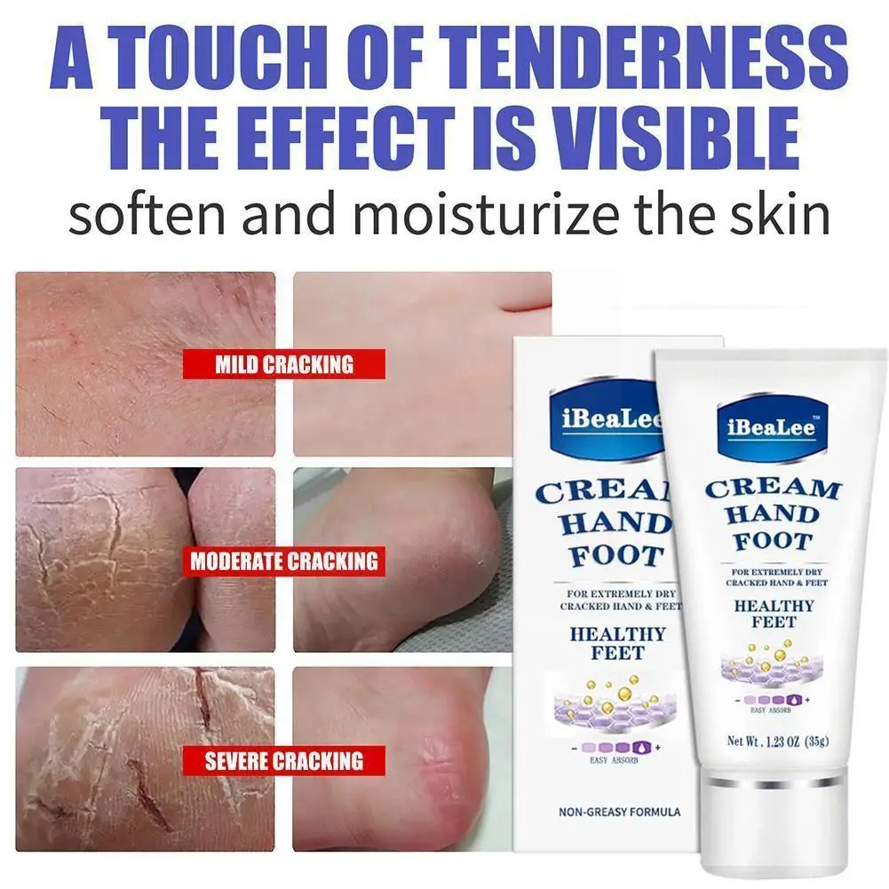 

Крем для ног Ibealee против трещин, средство для удаления пятки и пятки, восстанавливающий омертвевший крем, уход за ногами, пилинг для рук Ca O6o9