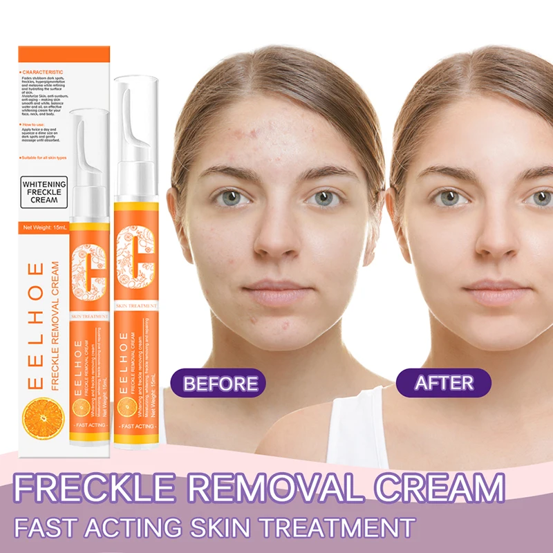 

Vitamin C Whitening Anti Freckle Pen Instant Blemish Removal Gel Freckle The Effectively Melanin Spots Cream Pigmented Remover