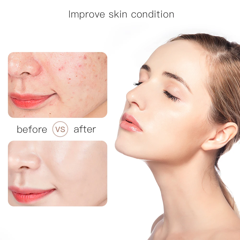 Беспроводная ручка для мезотерапии электрический перо ухода за кожей