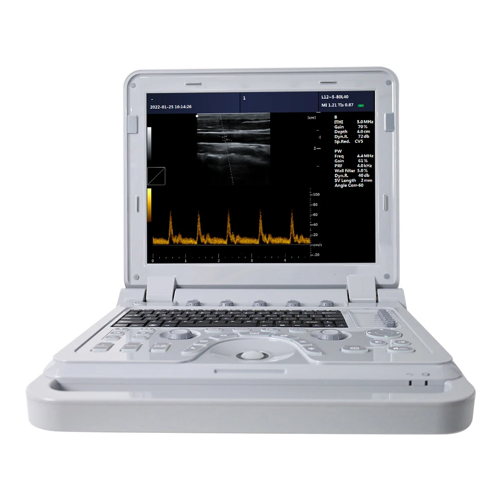 

Contec CMS600P2PLUS portable ultrasound machine pseudo Color Doppler Ultrasonic Diagnostic System