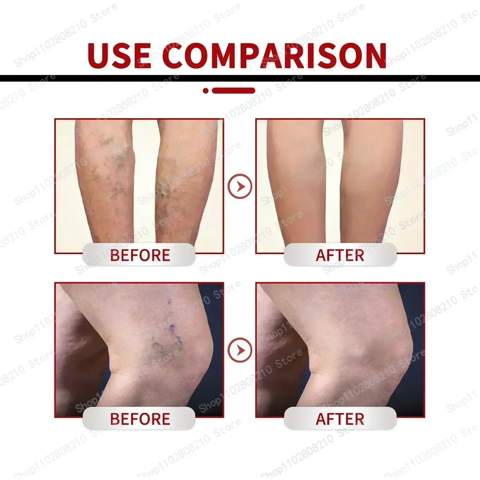 Privates Антибактериальный крем Мошонка Экзема Щедрый Кририс Грибковое инфекция