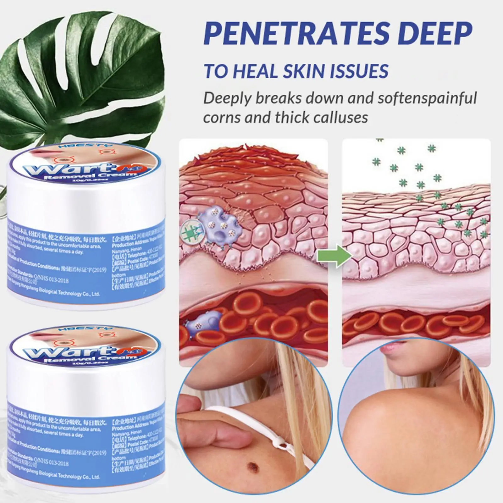 

10G Wart Remover Safe Painless Skin Tags Removal Ointment Fast Acting Remover Cream for Warts Moles Corn for All Skins S3Z9