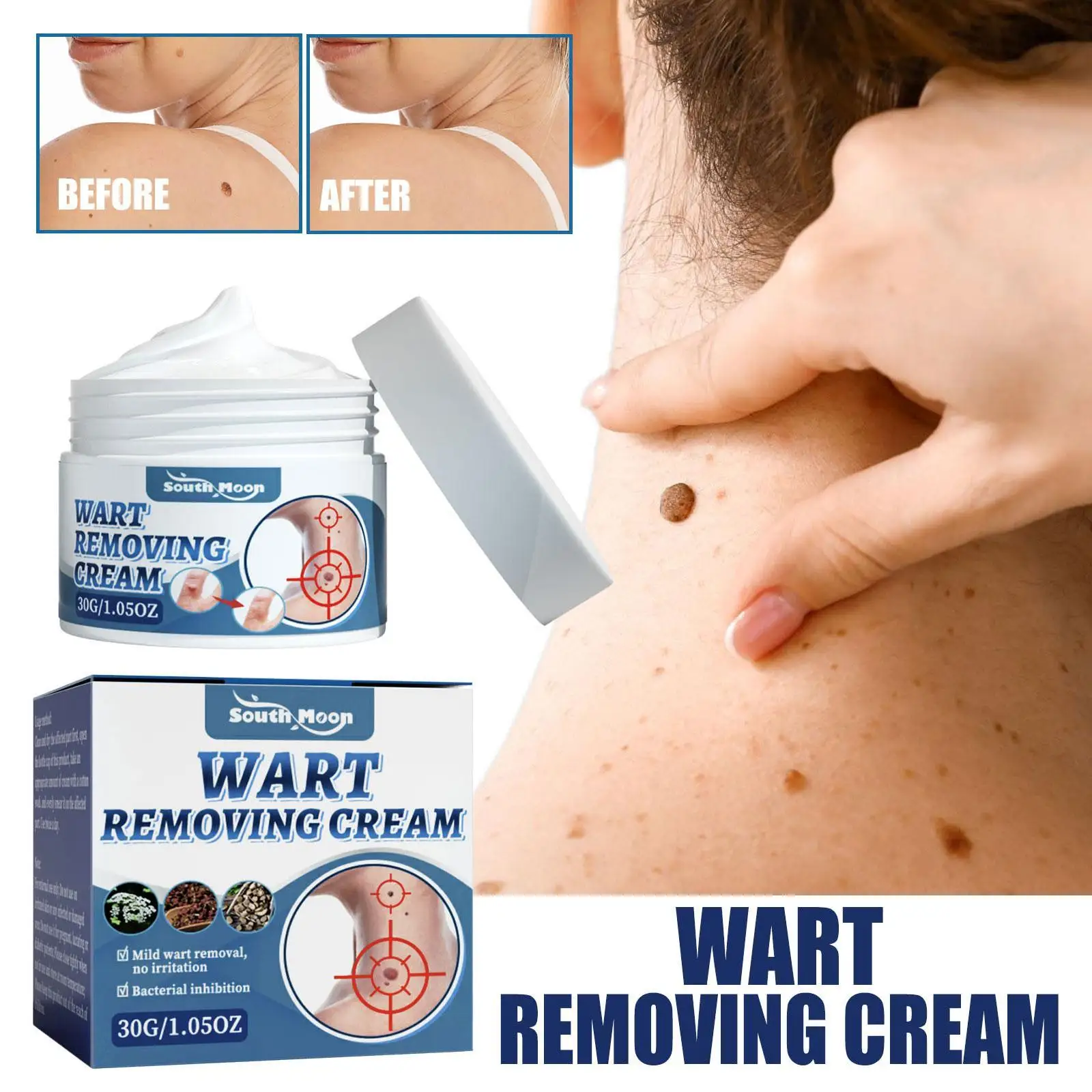 

Эффективный женский крем-подошва для ног, бородавок, мазь для шеи, лица, подмышек, антибактериальный безболезненный уход за кожей