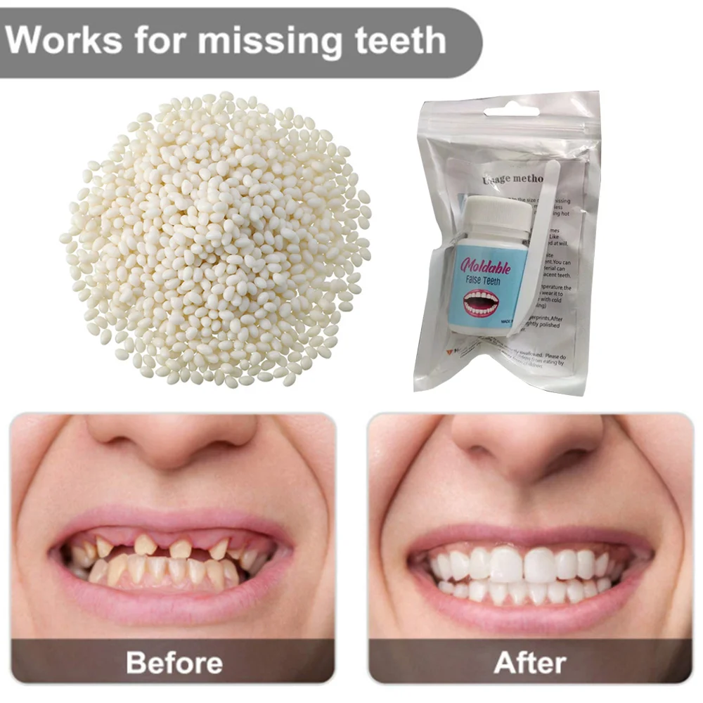 

1box Dental Resin Shapeable Teeth Glue Makeup Dentures Modification Temporary Filling Teeth Repair Broken Tooth Gaps Accessories