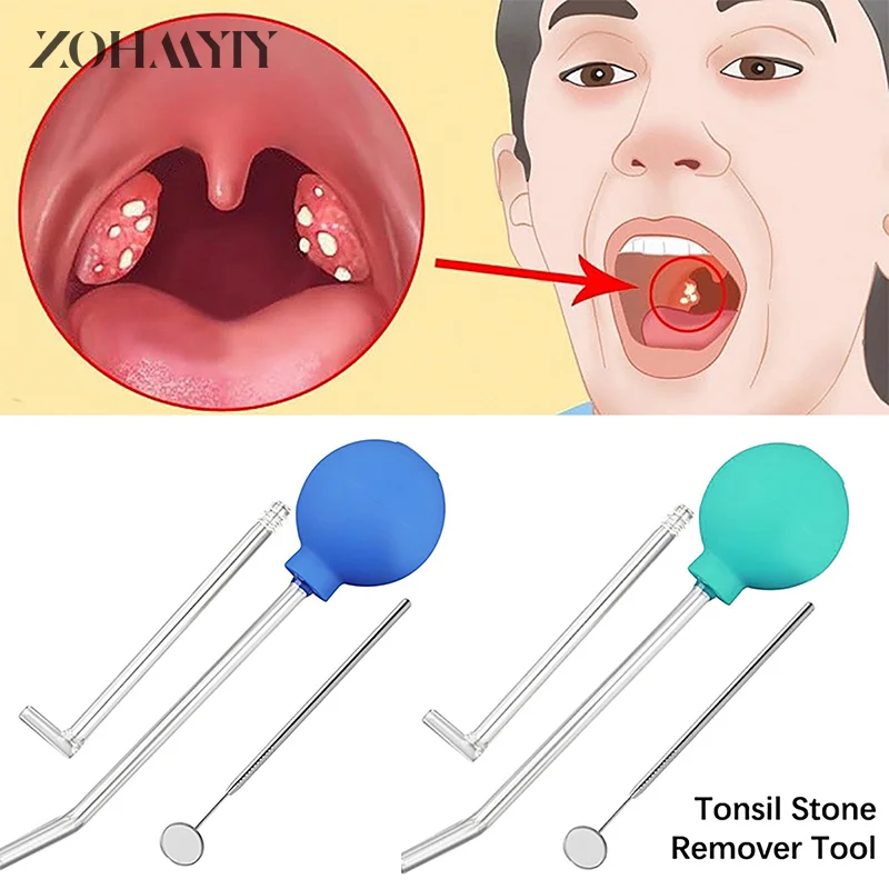3 шт./набор инструменты для удаления миндалин