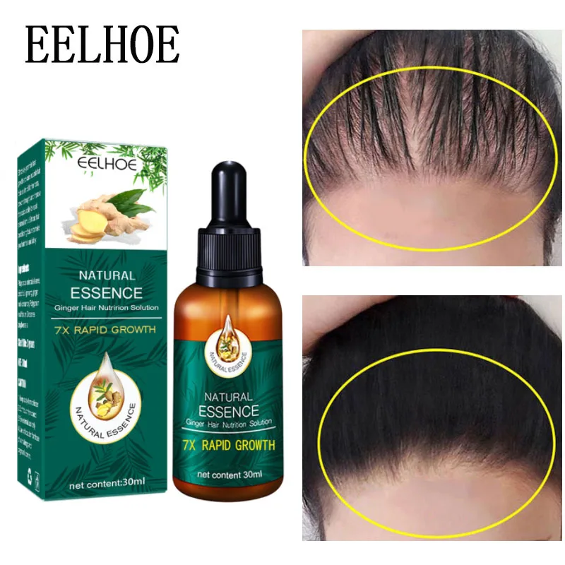 

Ginger Hair Growth Essential Oil Serum Anti Hair Loss Products Care Fast Grow Repair Treatment Dry Frizzy Damaged Thinning Hair