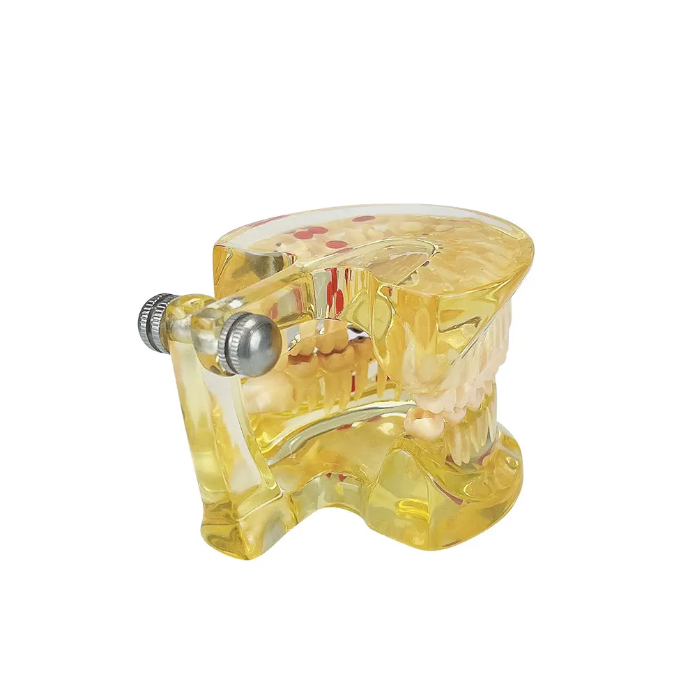 Модель для обучения стоматологии полусъемные зубы патологическая модель