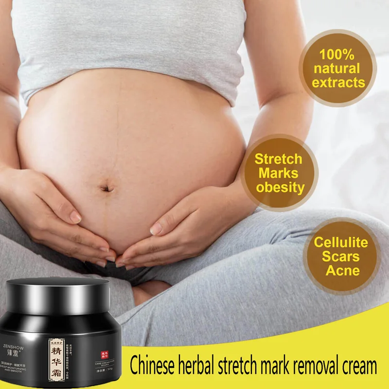 

Крем Для Удаления растяжек с кожи, масло для беременных и беременных женщин, крем для удаления старых растяжек