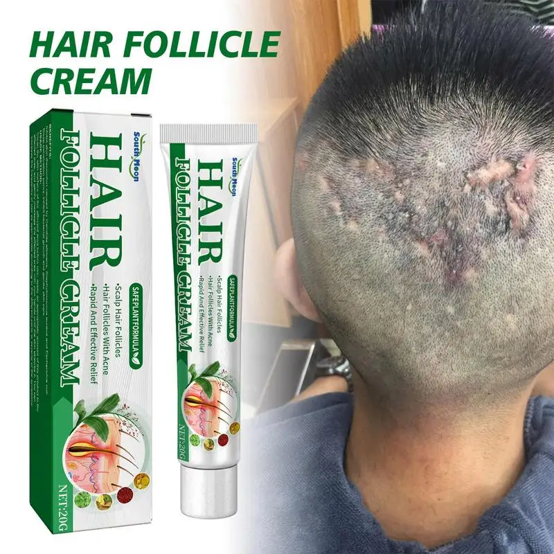 

Folliculitis Cream Scalp Hair Folliculitis Herbs Pustules Ulcers Medicine Spot Remover Skin Ointment Cysts Papules