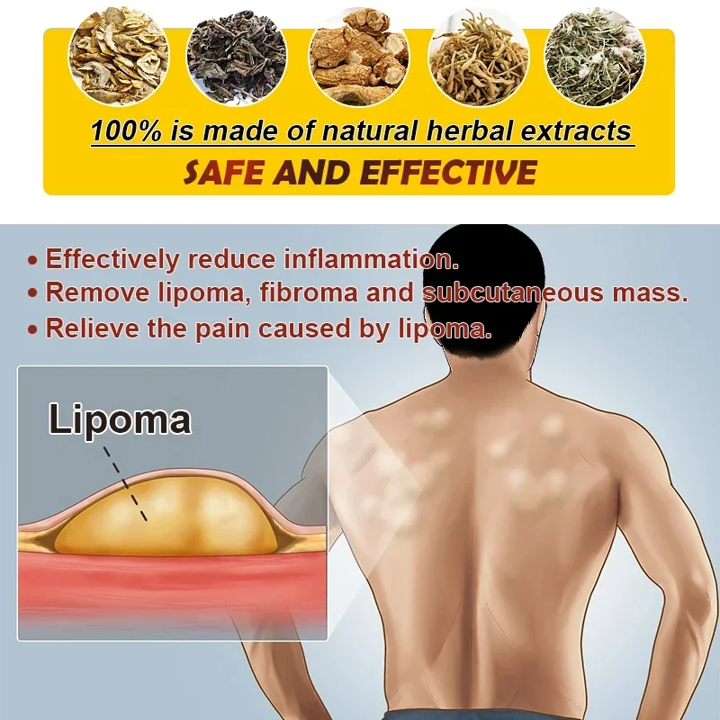 Крем Lipoma для удаления жира 20 г