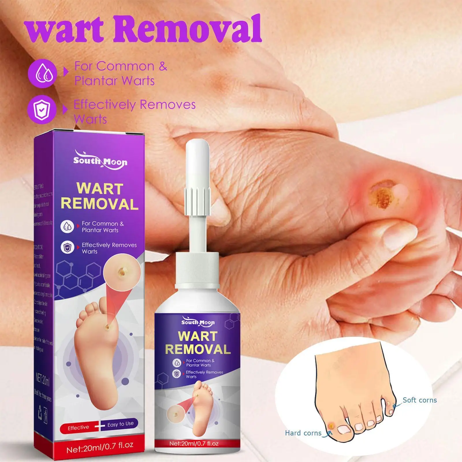 

20ml Skin Tag Removal Treatment Liquid Fast Wart Removal Treatment Foot Anti Corn Acne Lotion Spot N4Z1