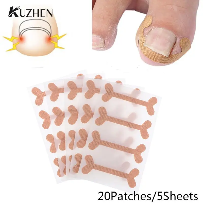 20Patches Ingrown Toenail Band Aid Relief Pain Paronychia Correction Pedicure Elastic Force Sticker Repair Bandage Toe Nail Care