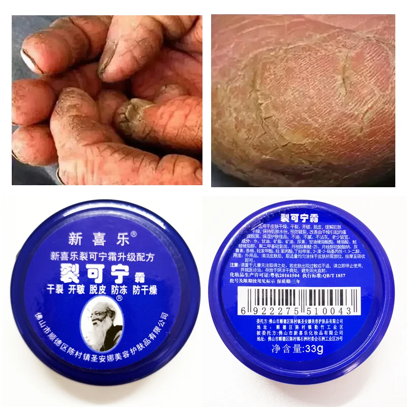 

Anti Dry Crack Powerful Frozen Cracking Cream Prevent Repair Skin Dry Chapped Frozen Frostbite Chinese Medicinal Ointment 33g