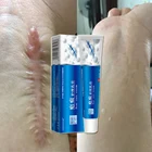 Крем для удаления шрамов от акне, прыщи, растяжки, гель для лица, удаление акне, разглаживание, отбеливание, уход за кожей, корректор пигментации