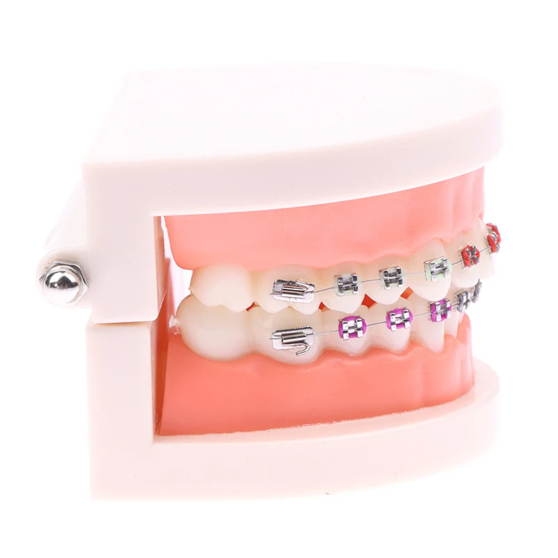 Стоматологическая Ортодонтическая модель полуметаллические керамические скобы