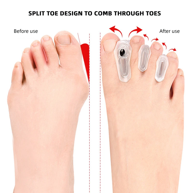 2 пары силиконовых разделителей пальцев ног уход за ногами корректор бурсита